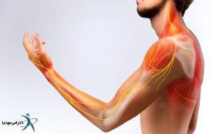 علائم دیسک گردن