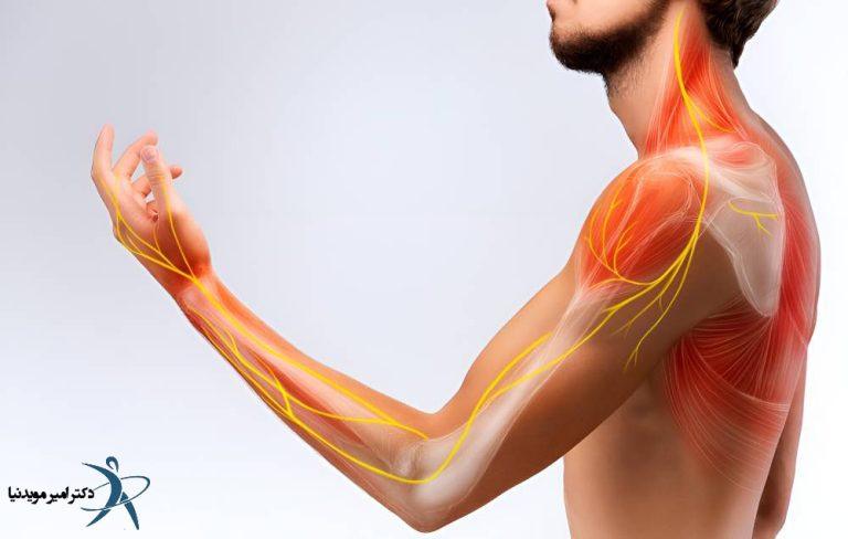 علائم دیسک گردن