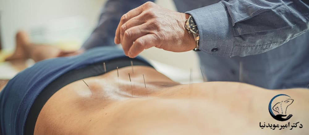 طب سوزنی جهت تسکین درد سیاتبک