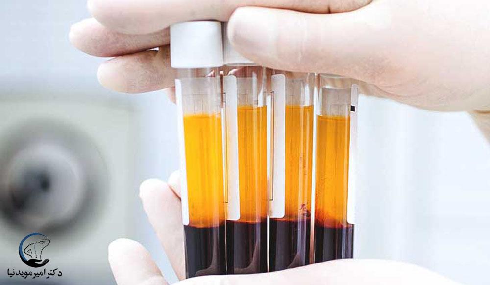 تزریق PRP یکی از روش‌های کم تهاجمی برای درمان درد سیاتیک