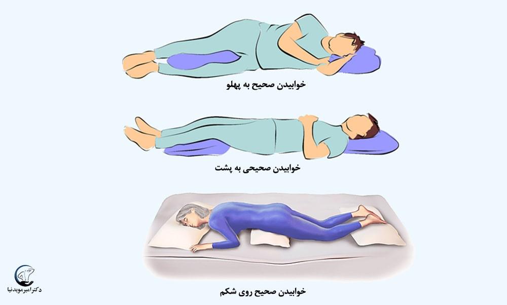 نحوه خوابیدن صحیح برای بهبود دیسک کمر