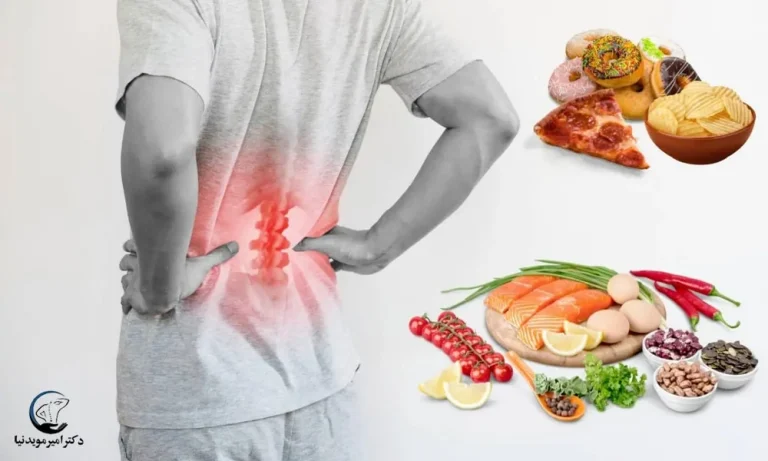 غذاهای مفید برای تنگی کانال نخاع